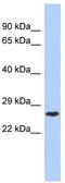 DIRAS Family GTPase 1 antibody, TA340390, Origene, Western Blot image 