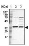 Solute Carrier Family 25 Member 21 antibody, PA5-51436, Invitrogen Antibodies, Western Blot image 