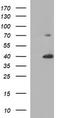 Uracil Phosphoribosyltransferase Homolog antibody, TA506875S, Origene, Western Blot image 