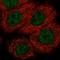 Von Hippel-Lindau Tumor Suppressor antibody, HPA031632, Atlas Antibodies, Immunocytochemistry image 