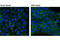 Epidermal Growth Factor Receptor Pathway Substrate 15 antibody, 12460S, Cell Signaling Technology, Immunocytochemistry image 