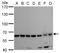 Archain 1 antibody, GTX630562, GeneTex, Western Blot image 