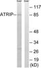 ATR-interacting protein antibody, TA312612, Origene, Western Blot image 