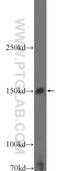 Janus Kinase 2 antibody, 17670-1-AP, Proteintech Group, Western Blot image 