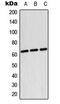 Testis Associated Actin Remodelling Kinase 2 antibody, GTX56036, GeneTex, Western Blot image 