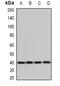 Sterol O-Acyltransferase 2 antibody, LS-C482909, Lifespan Biosciences, Western Blot image 