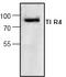 Toll Like Receptor 4 antibody, TA318891, Origene, Western Blot image 