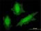Von Hippel-Lindau disease tumor suppressor antibody, H00007428-M01, Novus Biologicals, Immunocytochemistry image 