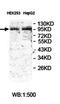 Putative Homeodomain Transcription Factor 2 antibody, orb78064, Biorbyt, Western Blot image 