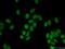 REC1 antibody, 11726-2-AP, Proteintech Group, Immunofluorescence image 