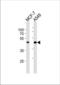 Cyclin-dependent kinase 20 antibody, TA324949, Origene, Western Blot image 