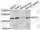 Enhancer Of Polycomb Homolog 1 antibody, A5807, ABclonal Technology, Western Blot image 