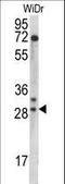 Mitochondrial Ribosomal Protein L9 antibody, LS-C164633, Lifespan Biosciences, Western Blot image 