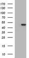 Tubulin Beta 2B Class IIb antibody, CF506600, Origene, Western Blot image 