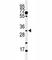 Apolipoprotein B MRNA Editing Enzyme Catalytic Subunit 3B antibody, F43047-0.4ML, NSJ Bioreagents, Western Blot image 