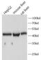 Complement Component 4 Binding Protein Beta antibody, FNab01114, FineTest, Western Blot image 