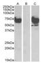 EPM2A Interacting Protein 1 antibody, orb22546, Biorbyt, Western Blot image 