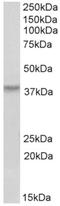 Homeobox protein Hox-A10 antibody, AP32972PU-N, Origene, Western Blot image 