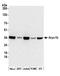 Actin Related Protein 2/3 Complex Subunit 1B antibody, A302-780A, Bethyl Labs, Western Blot image 