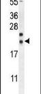 Nucleoredoxin Like 2 antibody, PA5-24065, Invitrogen Antibodies, Western Blot image 