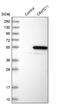 Acidic Residue Methyltransferase 1 antibody, NBP1-82276, Novus Biologicals, Western Blot image 