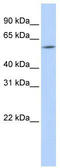 Homeobox protein ARX antibody, TA329347, Origene, Western Blot image 