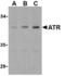 ANTXR Cell Adhesion Molecule 1 antibody, TA306121, Origene, Western Blot image 