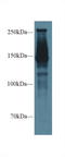 Spectrin alpha chain, brain antibody, LS-C298020, Lifespan Biosciences, Western Blot image 