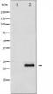 TIMP Metallopeptidase Inhibitor 1 antibody, TA325938, Origene, Western Blot image 