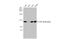 ATP Citrate Lyase antibody, GTX112387, GeneTex, Western Blot image 