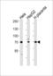 Activating Transcription Factor 6 Beta antibody, LS-C167029, Lifespan Biosciences, Western Blot image 