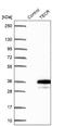 Trans-2,3-Enoyl-CoA Reductase antibody, NBP2-49230, Novus Biologicals, Western Blot image 