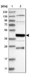 Small ArfGAP2 antibody, NBP1-80738, Novus Biologicals, Western Blot image 