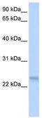 Serine And Arginine Rich Splicing Factor 3 antibody, TA345823, Origene, Western Blot image 