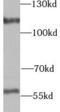 UTP14A Small Subunit Processome Component antibody, FNab09347, FineTest, Western Blot image 