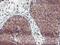 GRB2-related adaptor protein 2 antibody, M04115-1, Boster Biological Technology, Immunohistochemistry paraffin image 