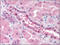 ATRX Chromatin Remodeler antibody, AM06038PU-N, Origene, Immunohistochemistry frozen image 
