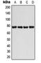 BMX Non-Receptor Tyrosine Kinase antibody, orb213609, Biorbyt, Western Blot image 