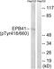 Erythrocyte Membrane Protein Band 4.1 antibody, AP55817PU-S, Origene, Western Blot image 