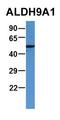 Aldehyde Dehydrogenase 9 Family Member A1 antibody, orb331054, Biorbyt, Western Blot image 