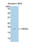 Cellular Communication Network Factor 4 antibody, LS-C297019, Lifespan Biosciences, Western Blot image 