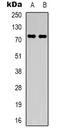 Pre-MRNA Processing Factor 39 antibody, LS-C368713, Lifespan Biosciences, Western Blot image 