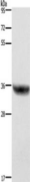 Hydroxysteroid 17-Beta Dehydrogenase 1 antibody, TA351268, Origene, Western Blot image 