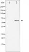Disabled homolog 1 antibody, TA325406, Origene, Western Blot image 
