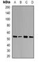 Ubiquilin-4 antibody, LS-C368936, Lifespan Biosciences, Western Blot image 