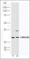 Chromodomain Helicase DNA Binding Protein 8 antibody, orb182587, Biorbyt, Western Blot image 
