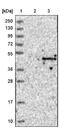 Prolactin-7D1 antibody, NBP1-85398, Novus Biologicals, Western Blot image 