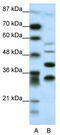 Zinc finger protein Gfi-1 antibody, TA329432, Origene, Western Blot image 
