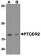 Prostaglandin D2 receptor-like antibody, TA319833, Origene, Western Blot image 