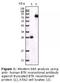 Bruton Tyrosine Kinase antibody, LS-C47221, Lifespan Biosciences, Western Blot image 